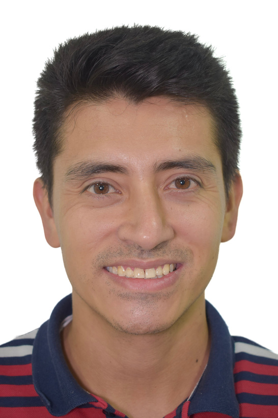 Vista inicial del diseño de sonrisa superior con resina inyectada