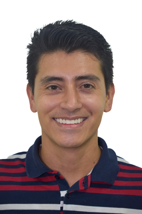 Resultado del diseño de sonrisa superior con resina inyectada