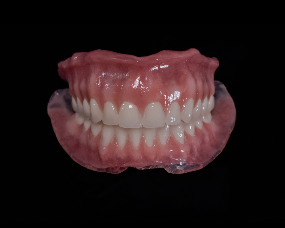 Prótesis Total de Alta Succión en Bucaramanga: La Alternativa a los Implantes - Tratamiento de prótesis realizado por el Dr. Cristhian Figueroa, especialista en odontología estética en Bucaramanga